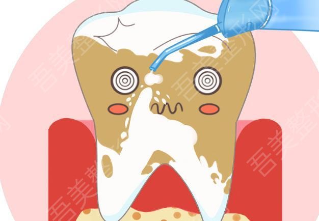 洗牙动漫图0.jpg