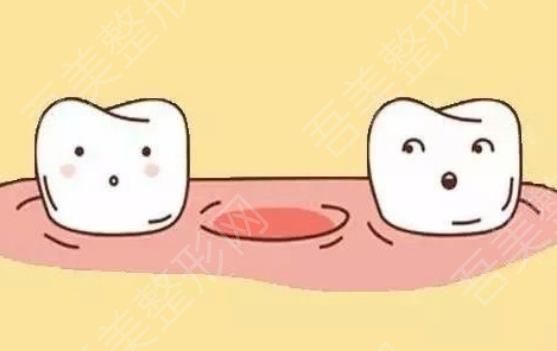 牙齿种植.jpg