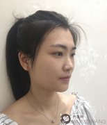 上海华美整形美容医院做双眼皮技术好不好？