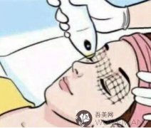 热玛吉除皱术后护理及注意事项~电波拉皮项目
