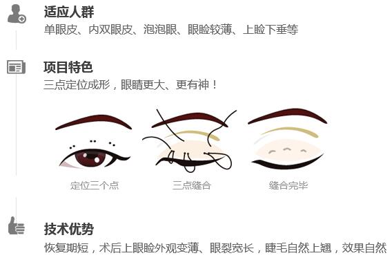 湖南省第二人民医院整形科讲解双眼皮