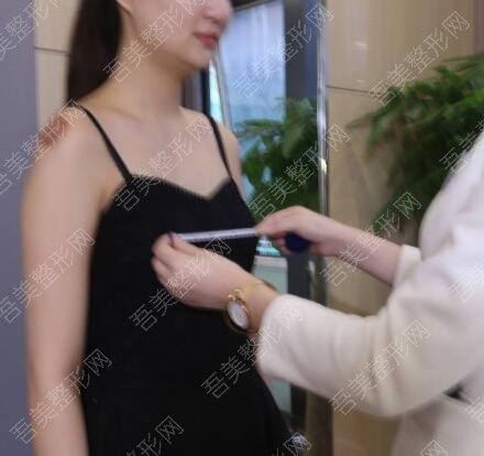 天津现代女子医院整形美容中心复合隆胸案例