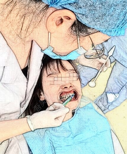 珠海六和口腔门诊部牙齿矫正(正畸)果图