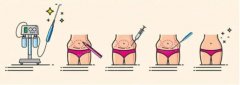 水动力吸脂瘦身效果图分享，“水桶腰”变“腰精”的整个过程！