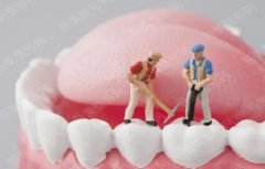 江苏省人民医院种植牙一颗多少钱？亲身经验：术后效果惊艳！