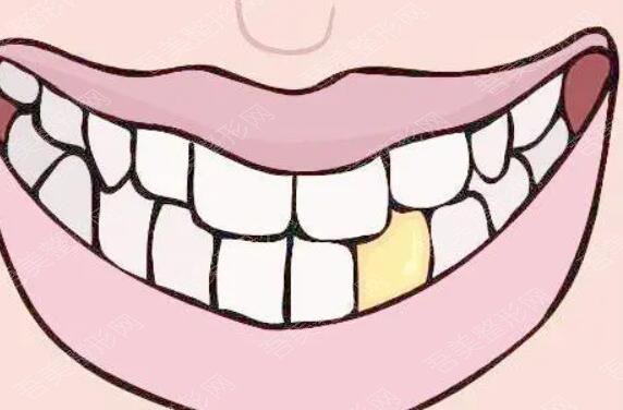 牙齿美白动漫17.jpg